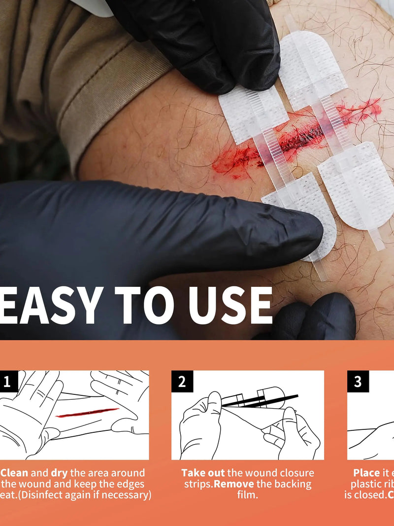 RHINO RESCUE Zip Stitch 6pcs, Wound Closure Strips Without Suture for Cut Care Device, Adhesive Bandages