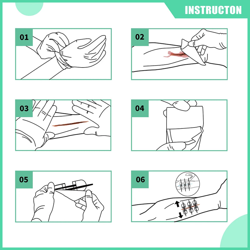 RHINO RESCUE Zip Stitch 6pcs with Wound Dresssings, Wound Closure Strips, Zipstitch Laceration Closure Kit for Cut Care Band-aid