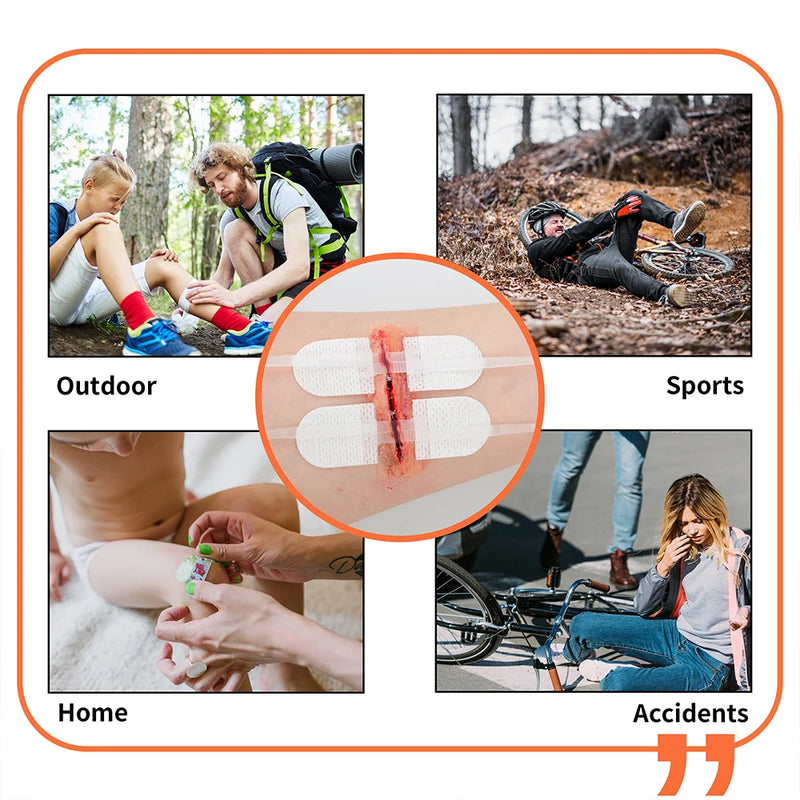 RHINO RESCUE Zip Stitch Wound Strips – No-Sew Laceration Repair for First Aid & Outdoors