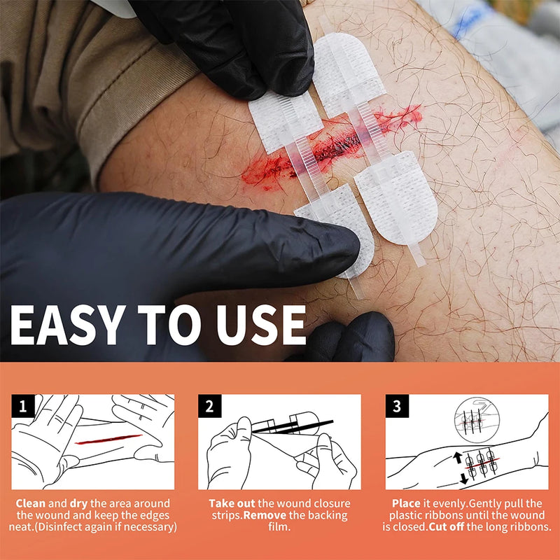 RHINO RESCUE Zip Stitch Wound Strips – No-Sew Laceration Repair for First Aid & Outdoors
