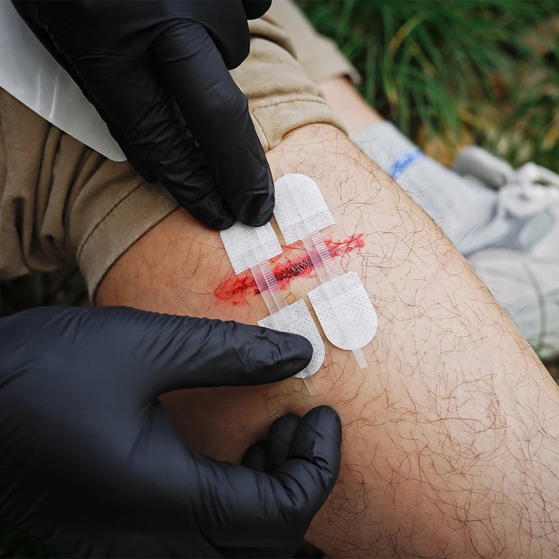 RHINO RESCUE Zip Stitch Wound Strips – No-Sew Laceration Repair for First Aid & Outdoors